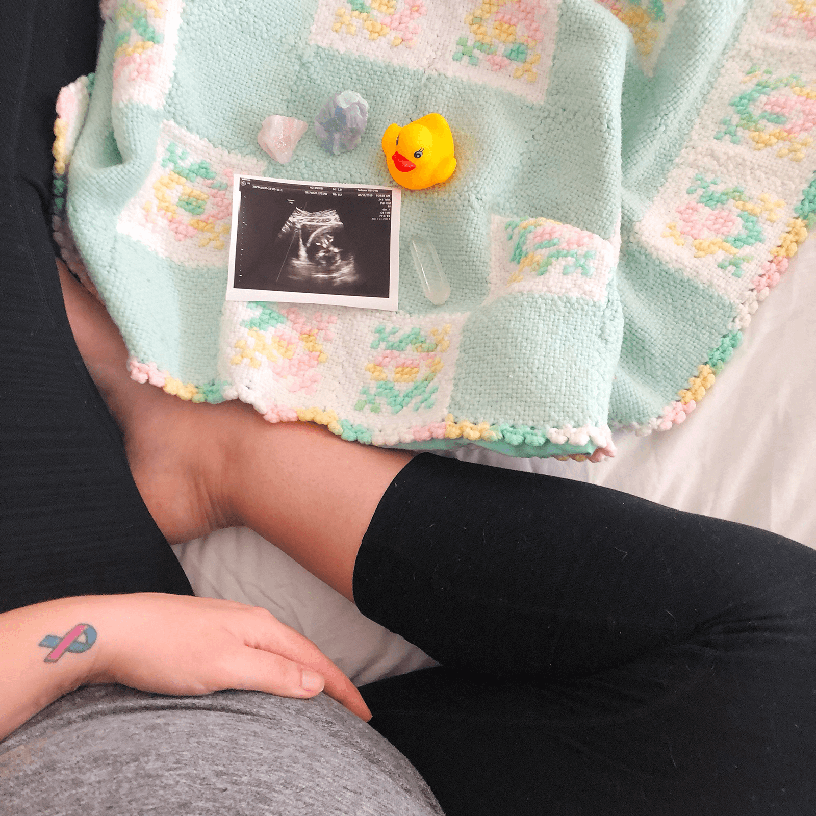 Coping With Pregnancy After Loss